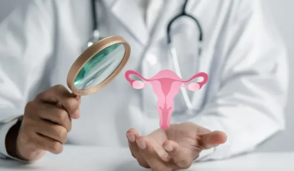 El SOP ahora se denomina PMOS- lo que las mujeres deben saber sobre el nuevo nombre y la atención integral