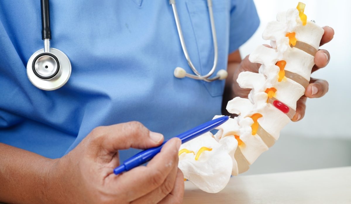 Asian,Doctor,Holding,Spinal,Nerve,And,Bone,Model,,Lumbar,Spine